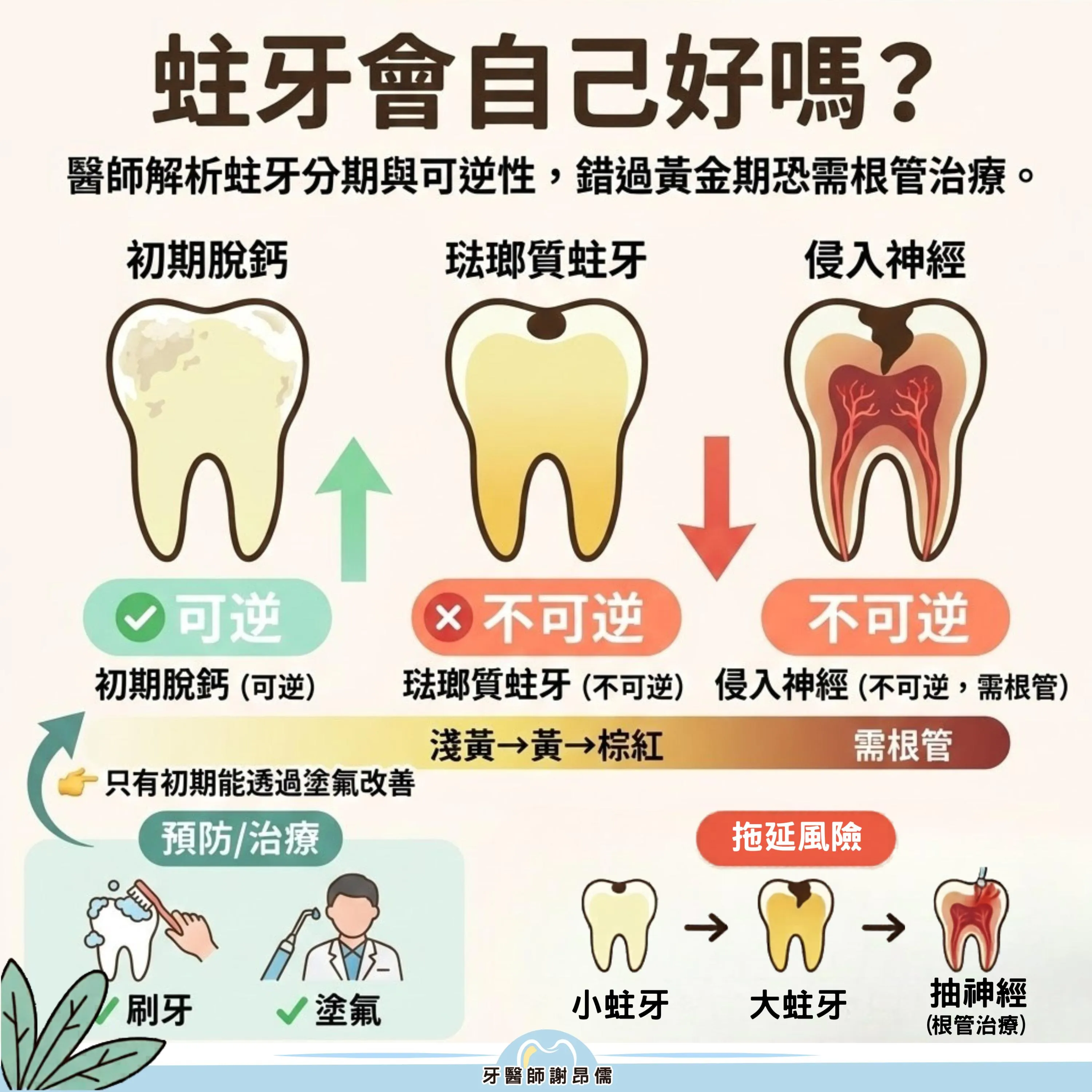 【蛀牙百科】蛀牙會自己好嗎？謝昂儒醫師解析：錯過「黃金期」恐需根管治療｜三重牙醫｜三重牙醫推薦｜三重牙醫診所｜台北牙醫｜台北牙醫推薦｜台北牙醫診所