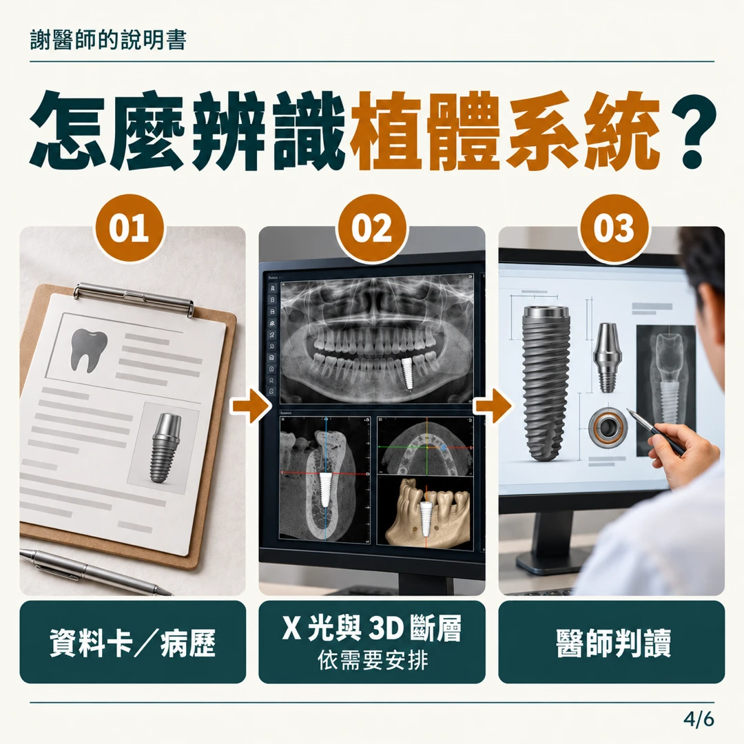 辨識植體系統的三個步驟:資料卡與病歷、X光與3D斷層、醫師判讀
