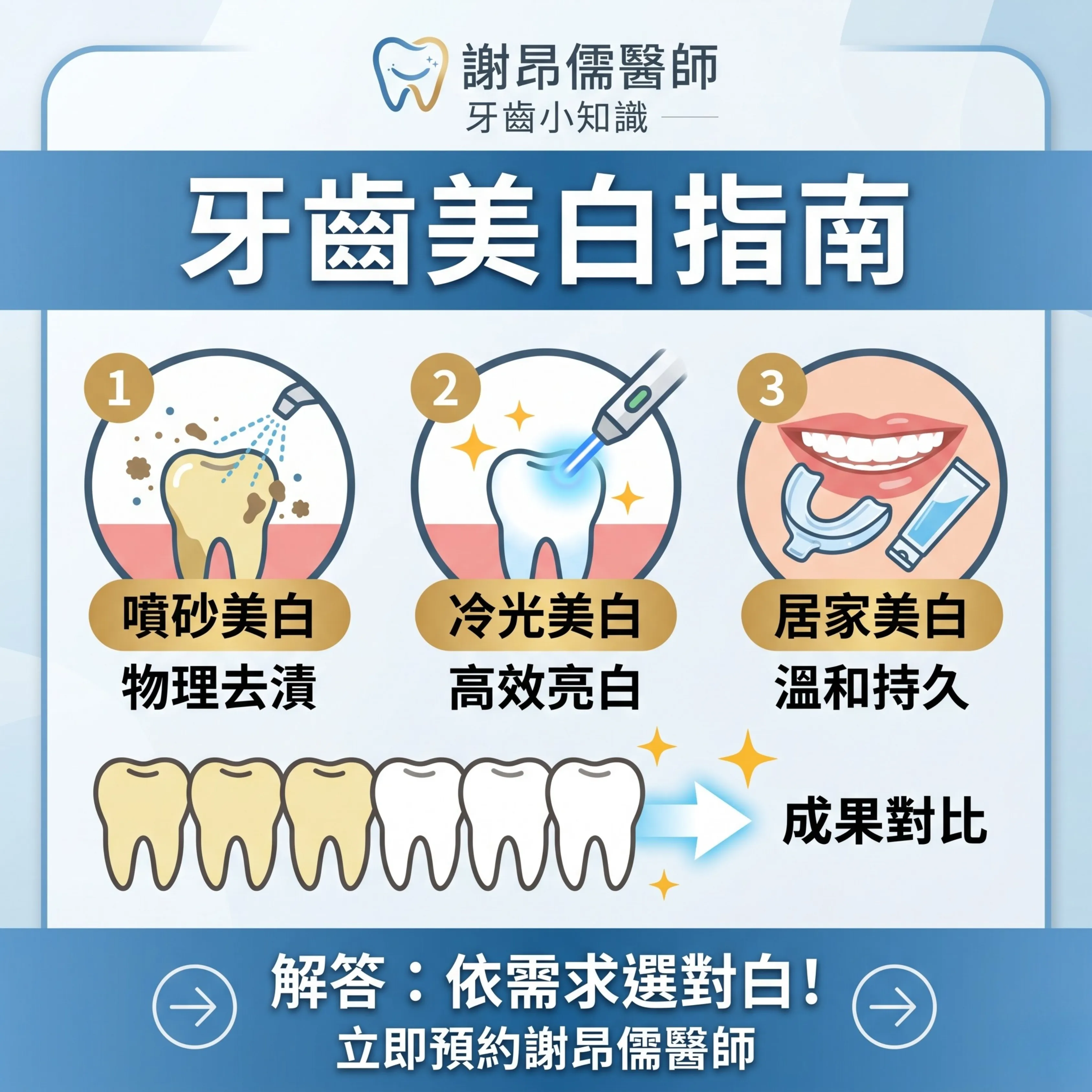 牙齒美白方法比較圖,詳細解析噴砂、冷光與居家美白差異,謝昂儒醫師專業美白指南