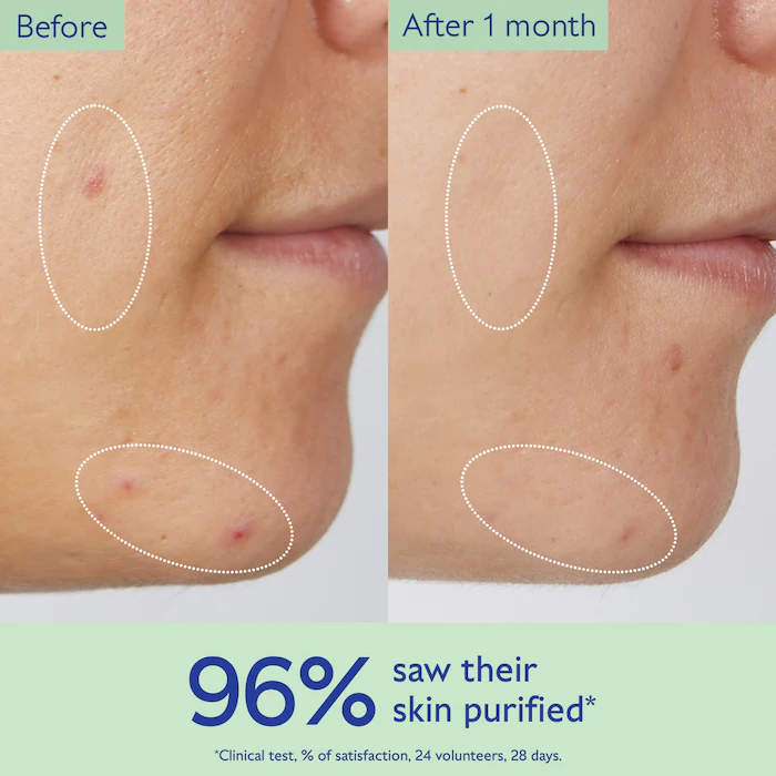 八折 Caudalie 毛孔淨化潔面膠