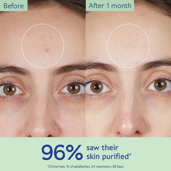 八折 Caudalie 毛孔淨化潔面膠