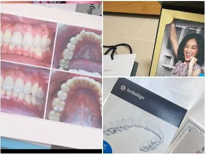 #曾經的嘴破大王蛻變了☺隱適美畢業真開心☺