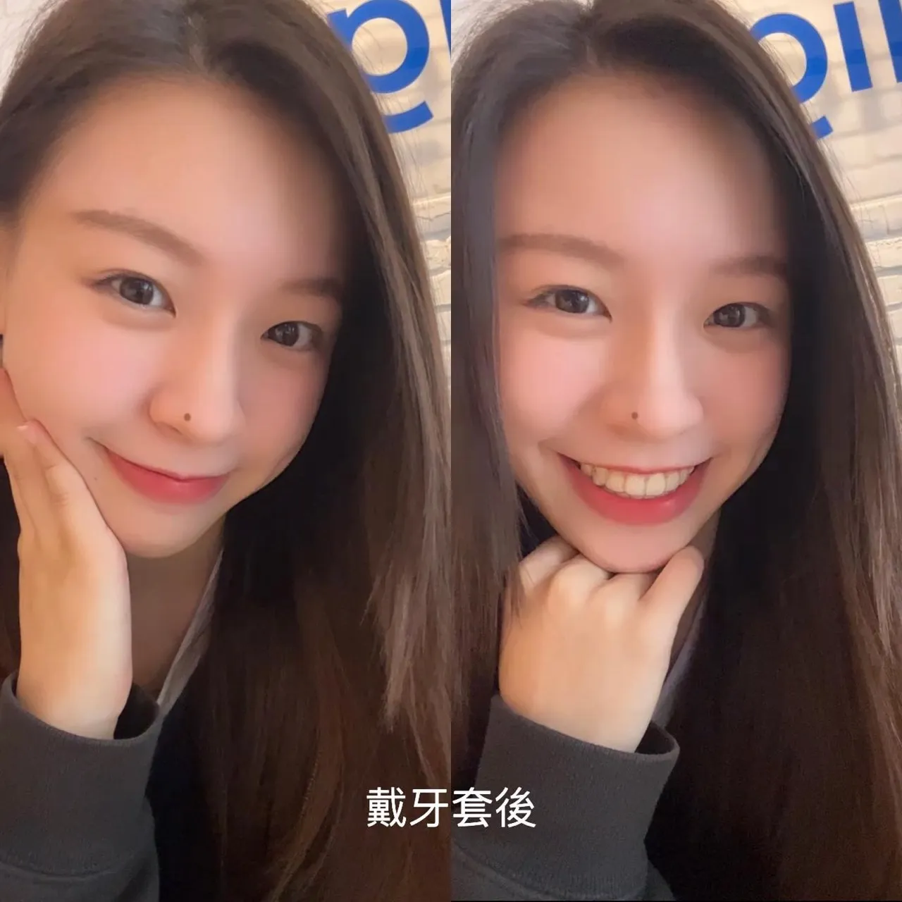 笑容是承裝著我對夢想的熱愛✨