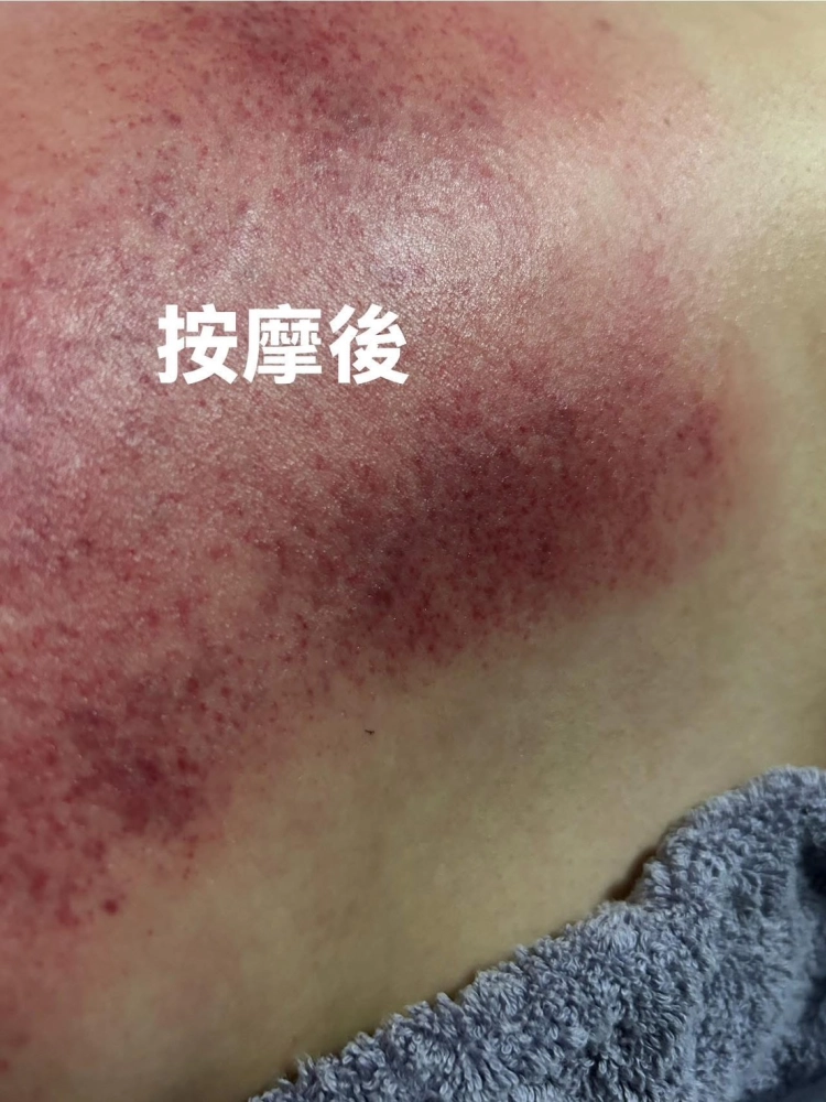 便秘按摩