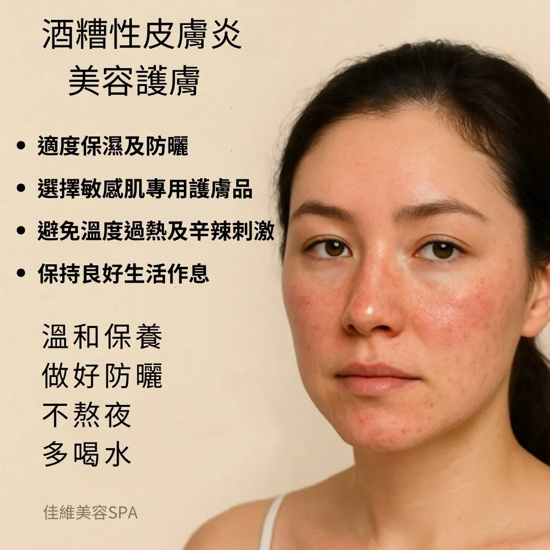 工作日常分享｜台北做臉｜板橋做臉