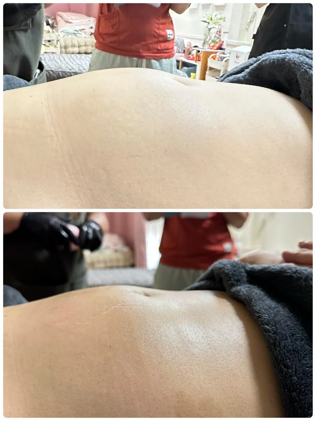 炎炎夏日，肚子總是脹脹的不舒服？