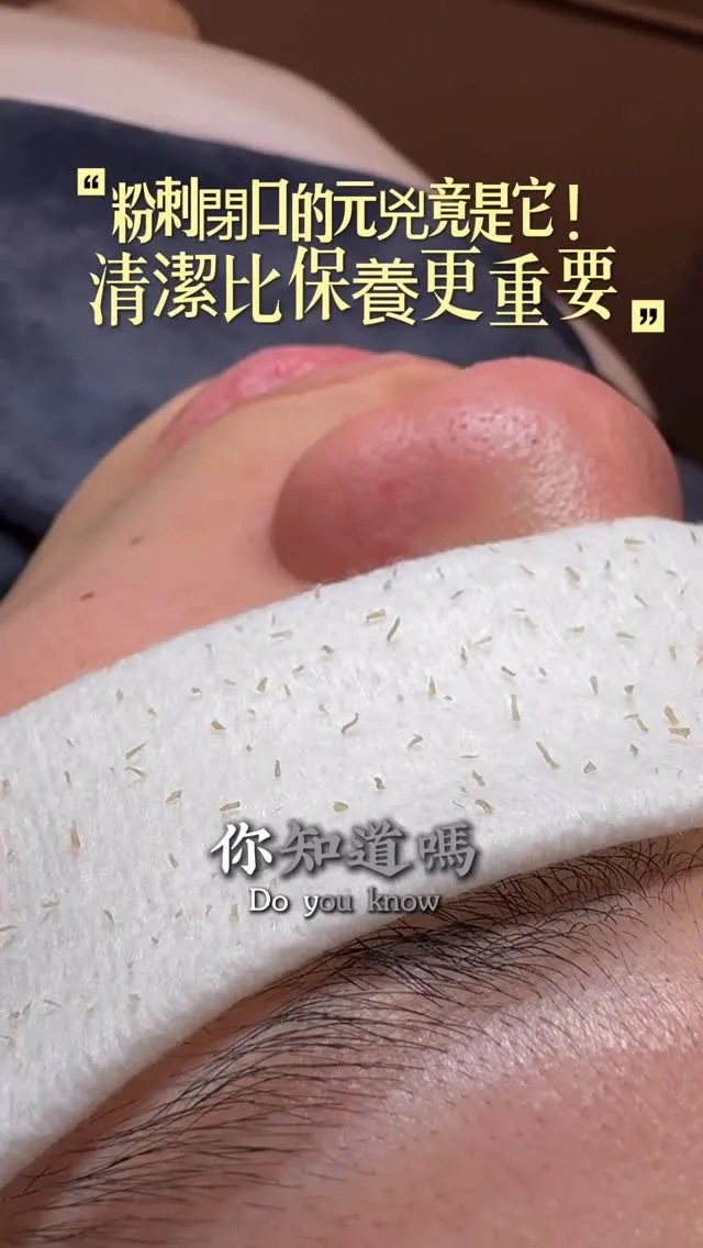 粉刺痘痘反覆不癒怎麼辦？從日常保養到專業護理全攻略！台北粉刺清潔｜汐止粉刺清潔｜