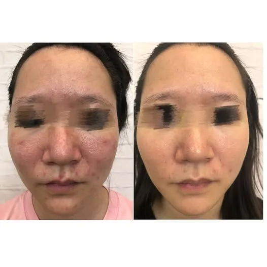 告別反覆敏感，找回肌膚防禦力