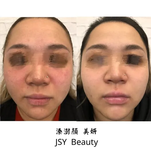 敏感肌也能亮麗健康，正確保養從基礎開始!!