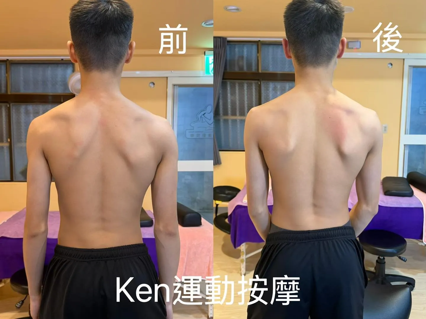 你是哪一種「緊繃型」？