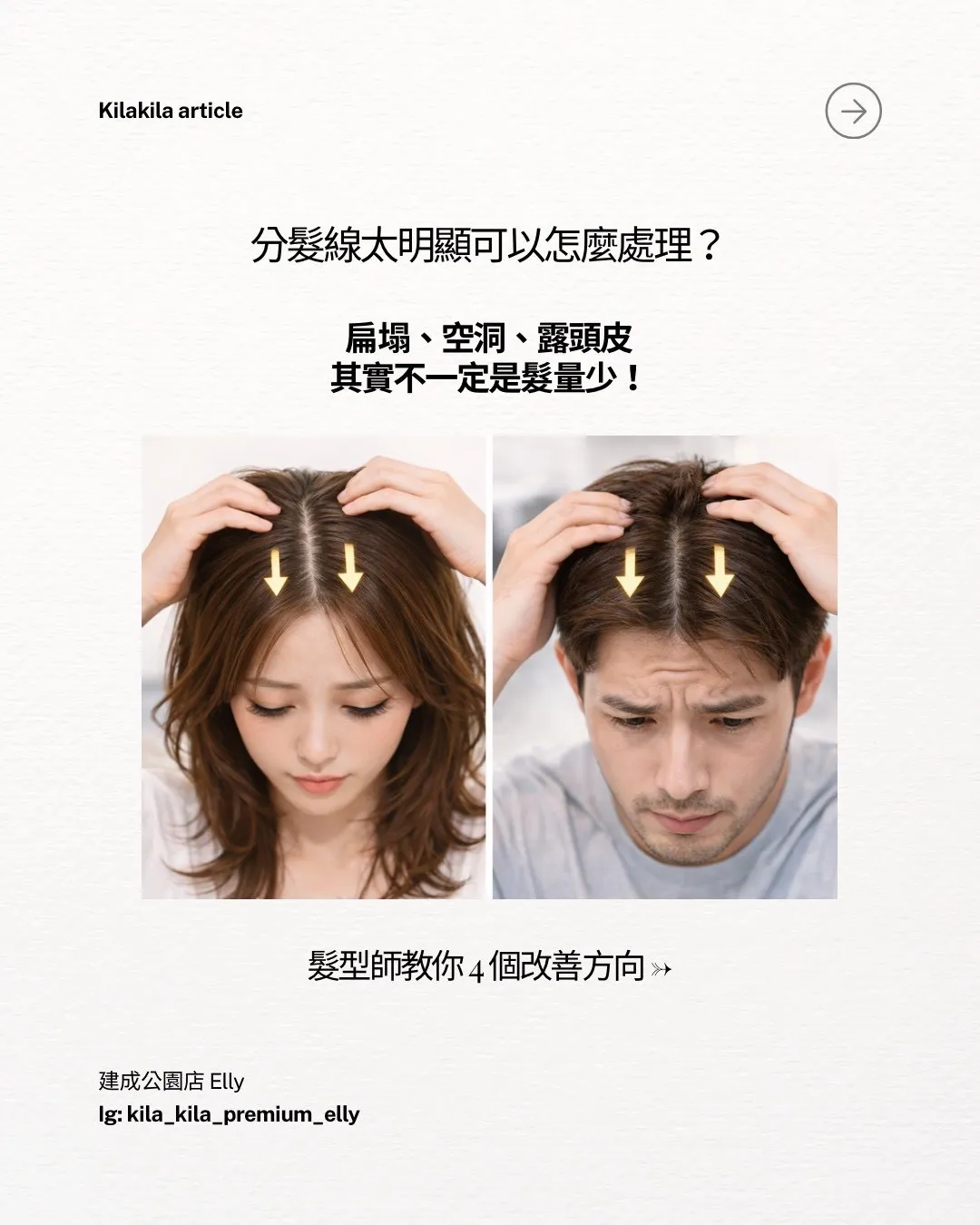 分髮線太明顯可以怎麼處理