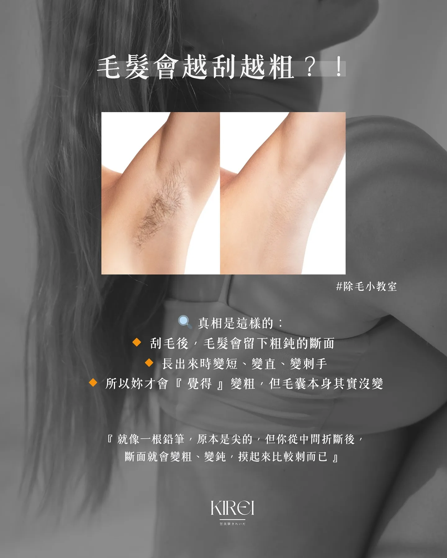 毛髮會越刮越粗？！
