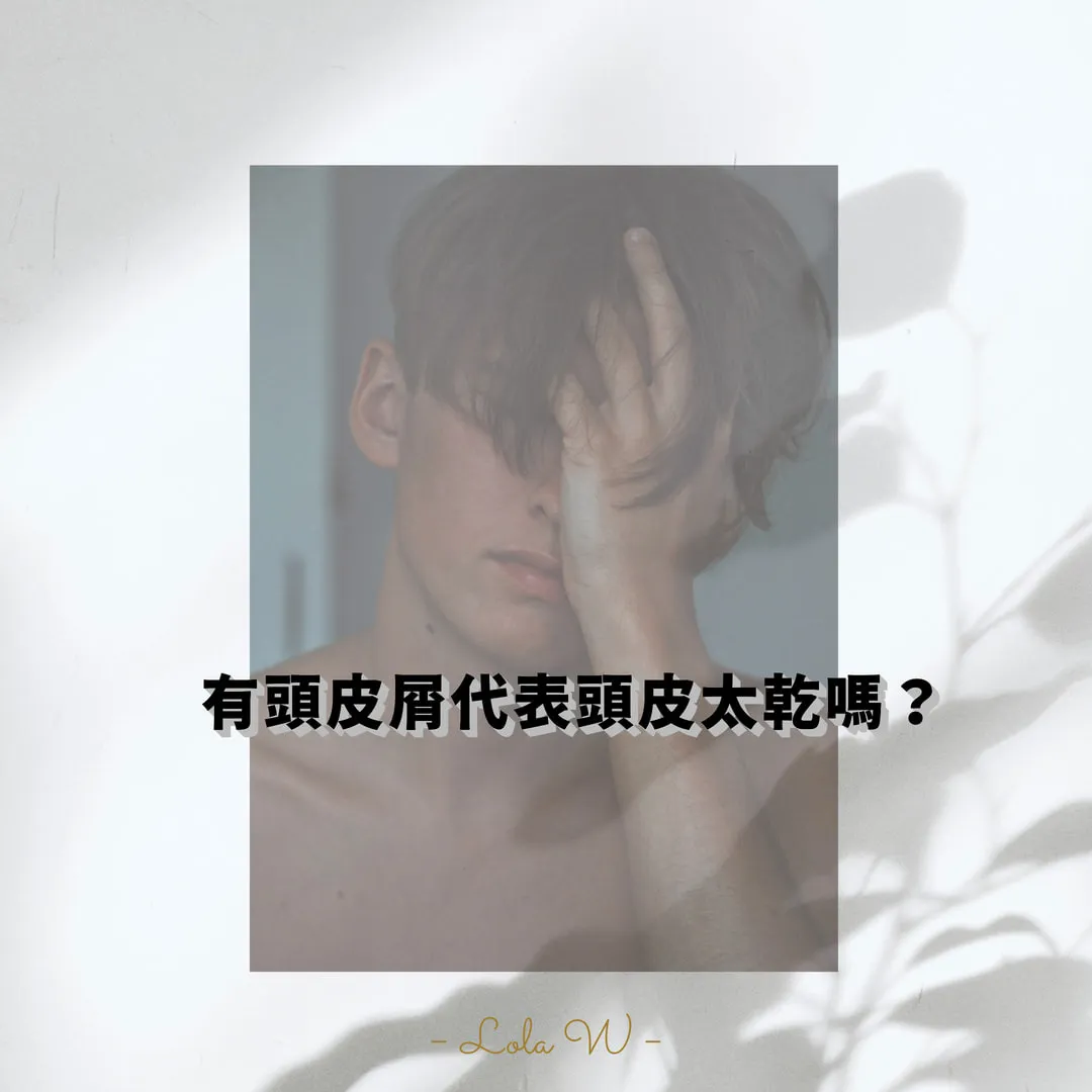 有頭皮屑代表頭皮太乾嗎?