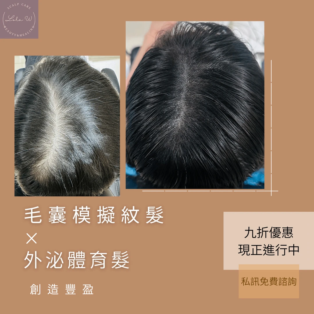 毛囊模擬紋髮優惠活動 ｜台中紋髮推薦