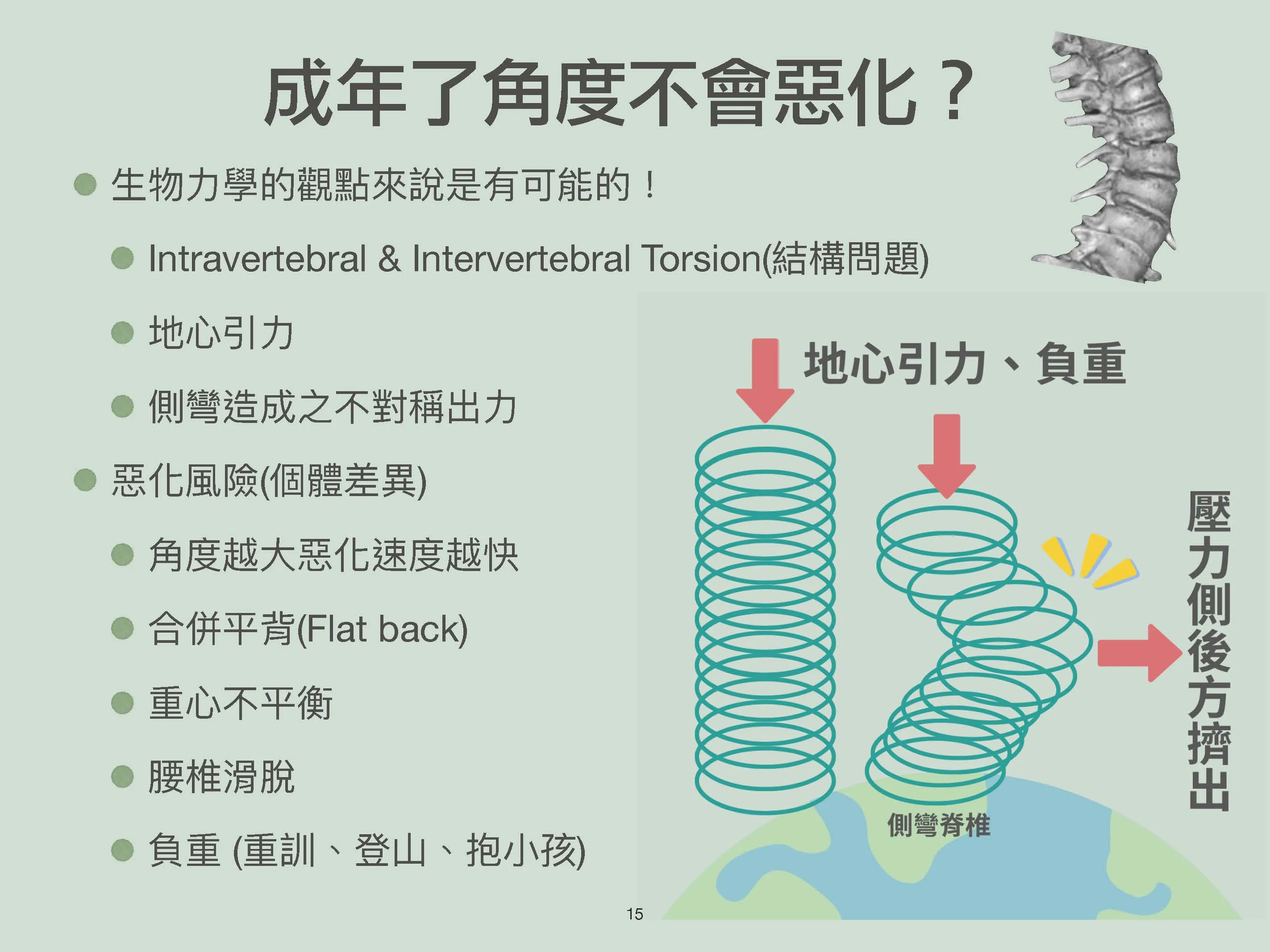 脊椎側彎 惡化的風險與因素