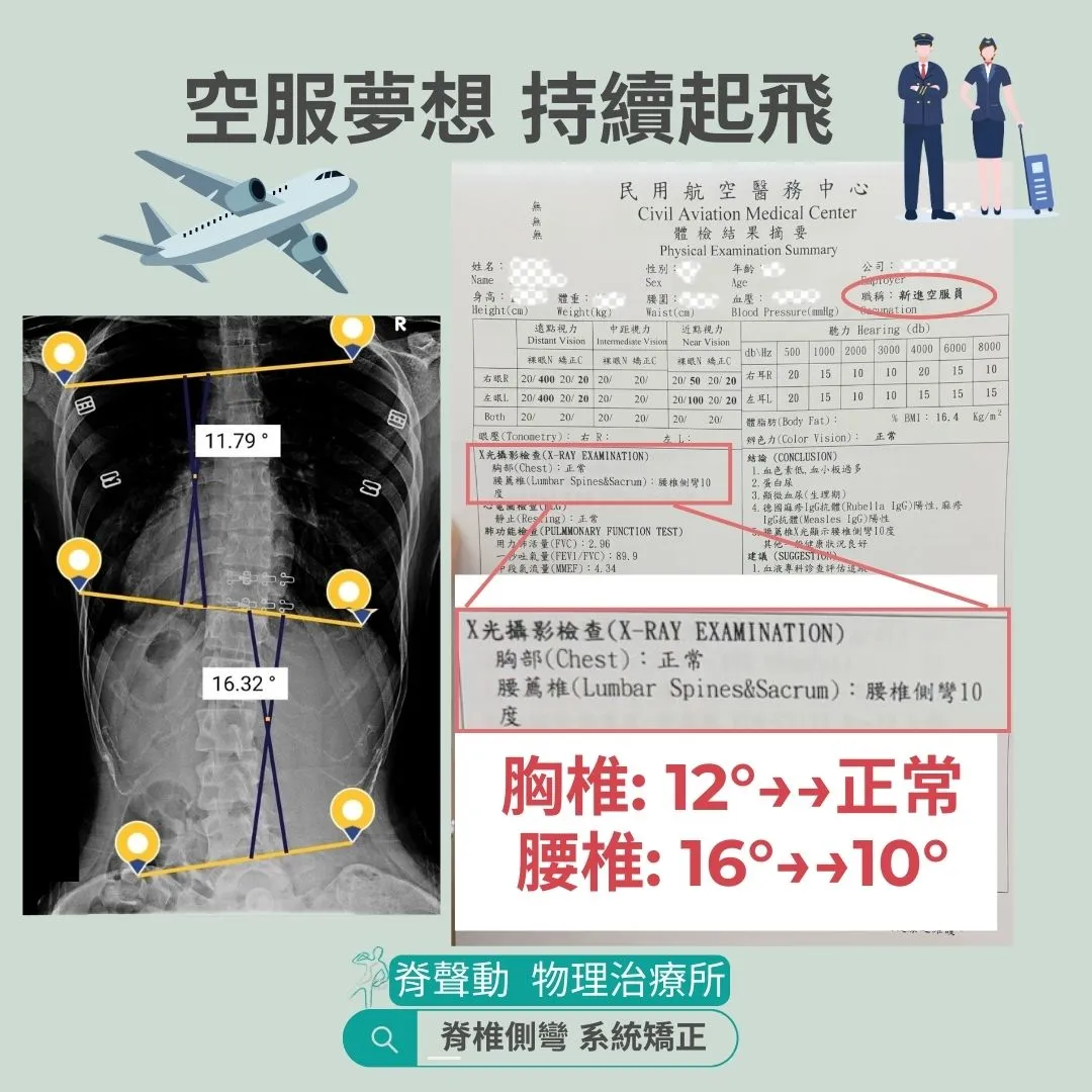 恭喜側彎人 錄取成為空服員^^ part.5
