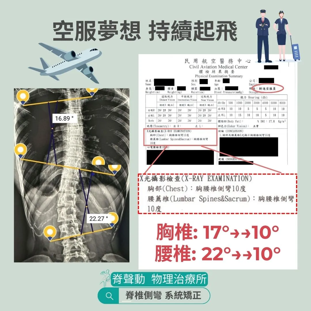 恭喜側彎人 錄取成為空服員^^ part.6