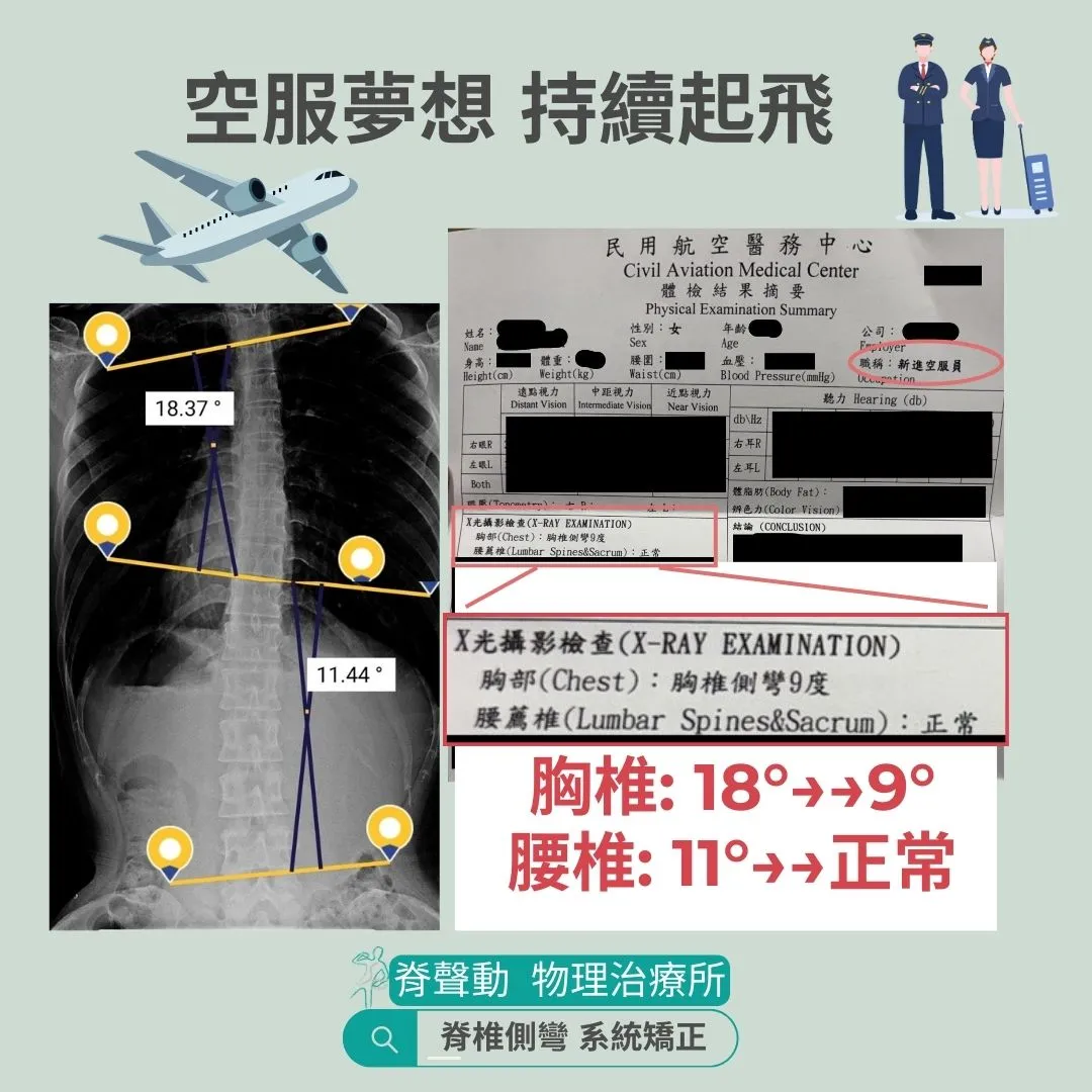 恭喜側彎人 錄取成為空服員^^ part.7