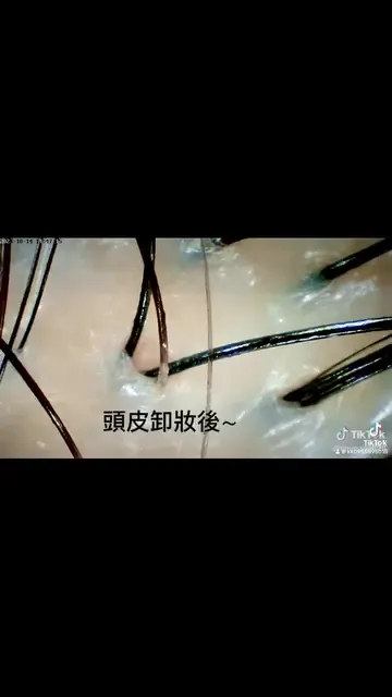 頭皮紓壓淨化