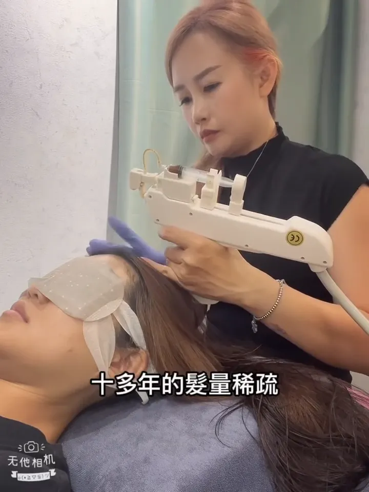 #頭皮不是等到出了問題才保養
