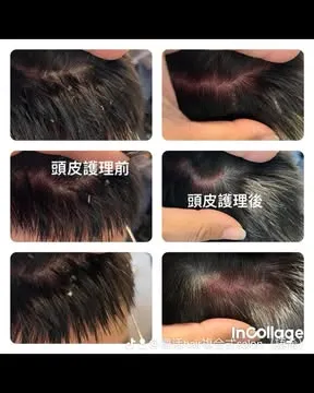造成落髮問題6大類