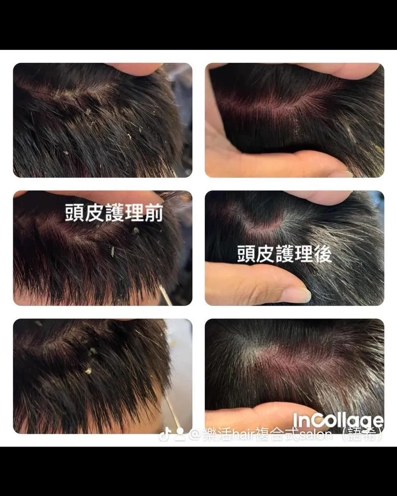 造成落髮問題6大類