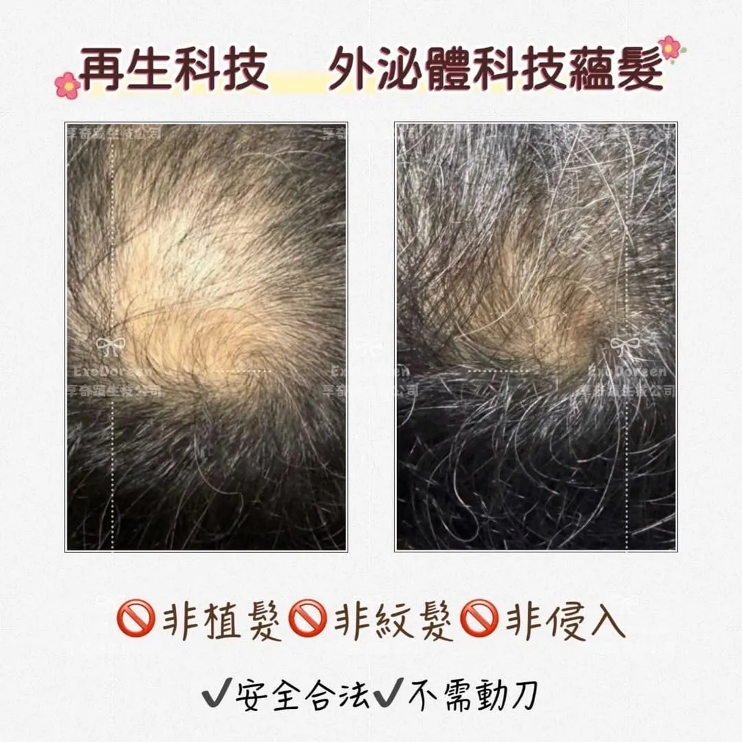 ✦科技育髮相關問題✦