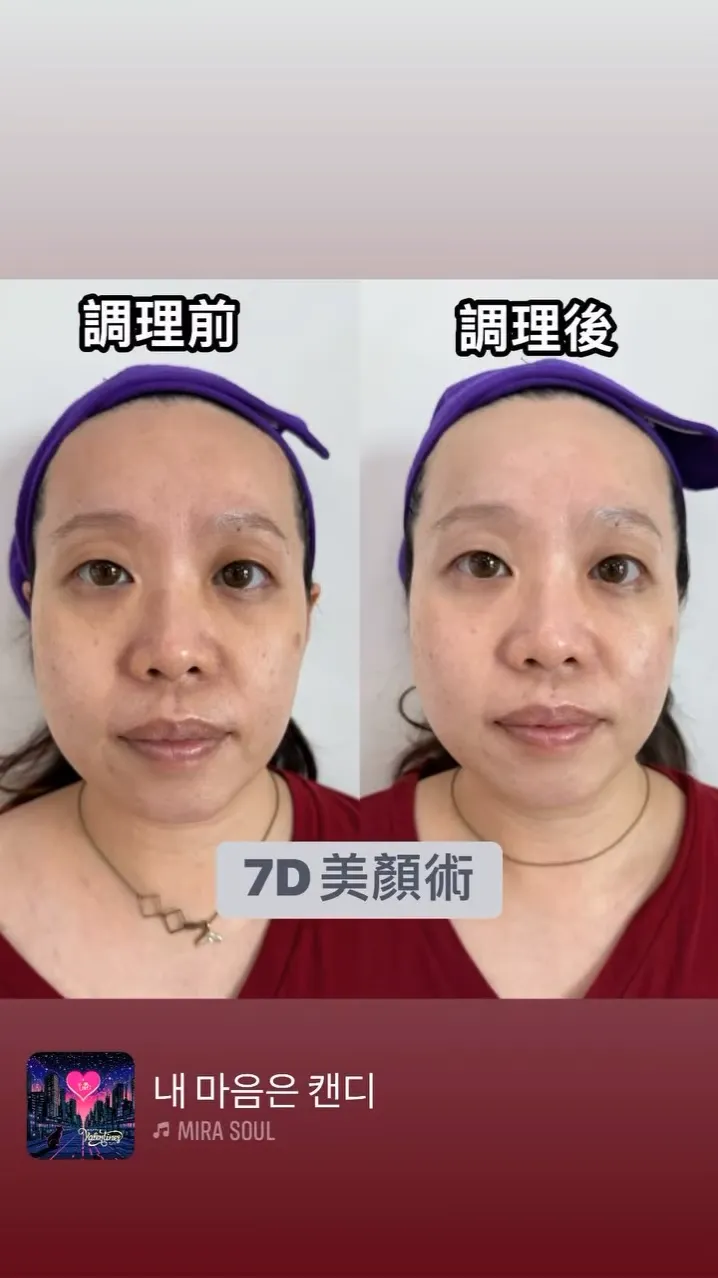 調理由內至外｜台中臉部撥筋推薦｜龍井臉部撥筋推薦