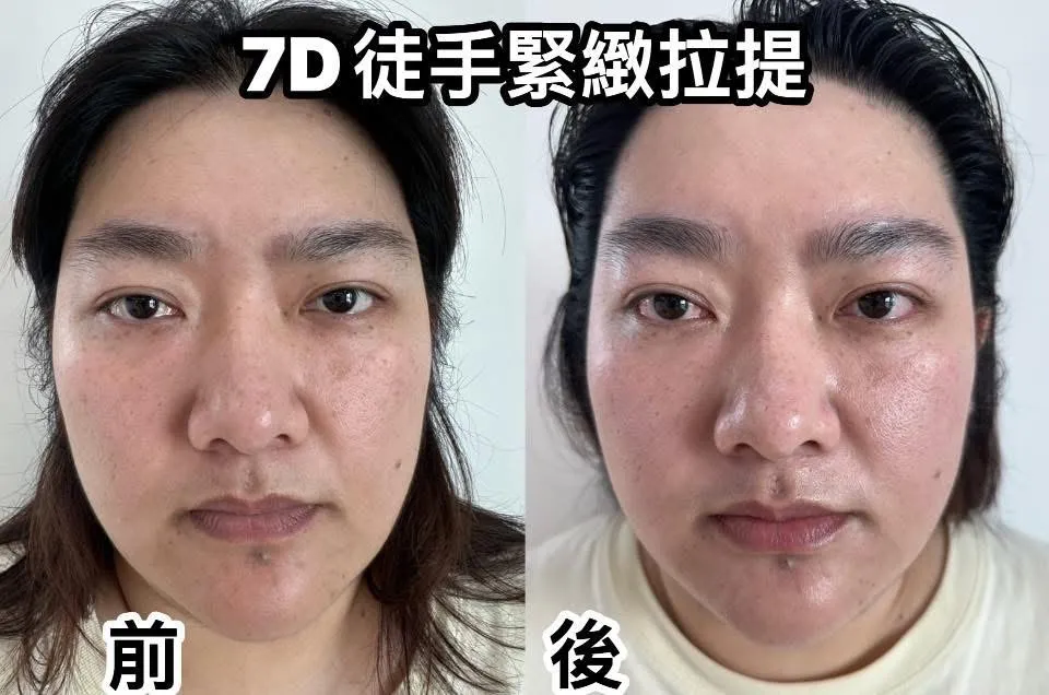 臉部暗沉 容易水腫 兩邊不對襯