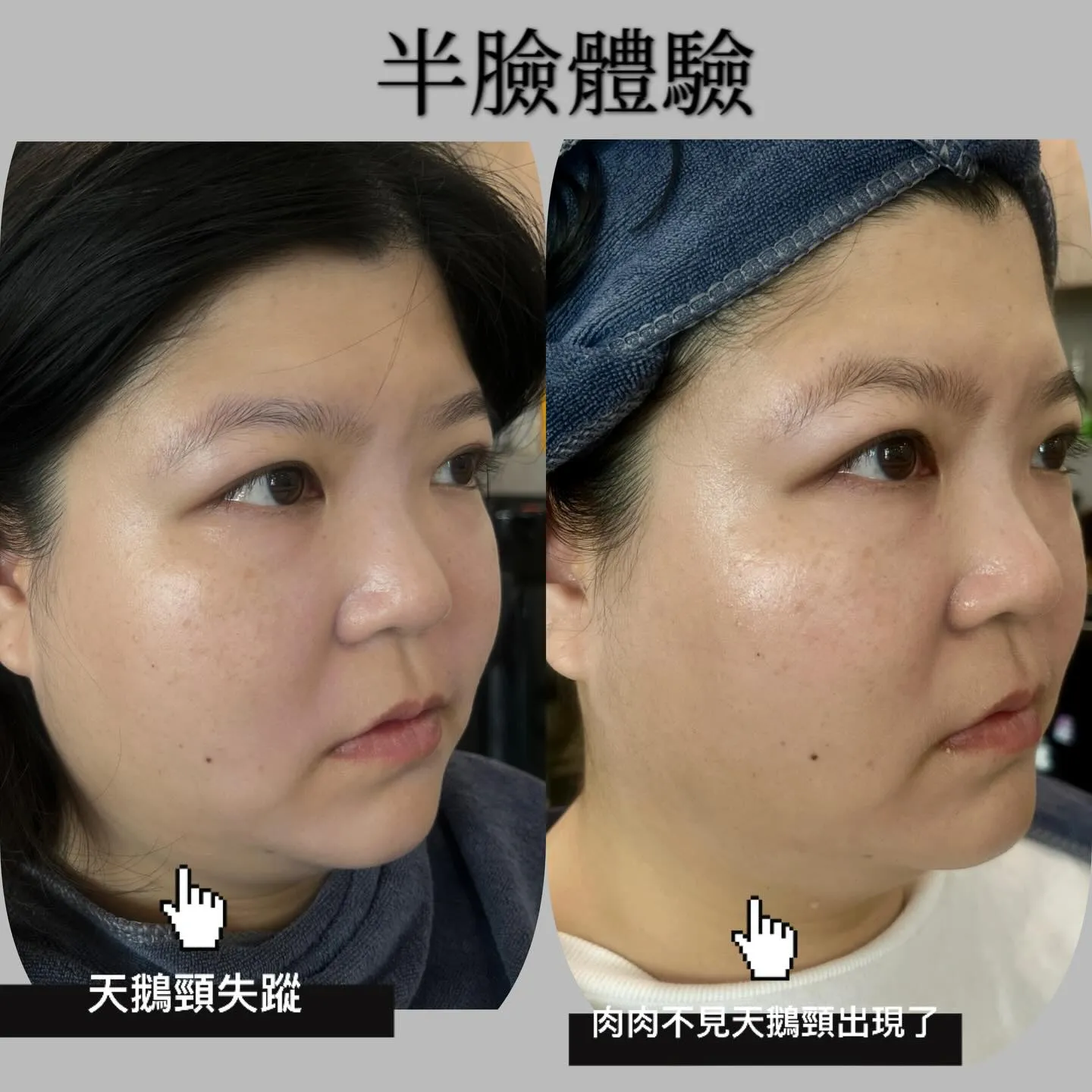 如果可以讓妳老到今天為止年輕3-5歲妳可以接受嗎