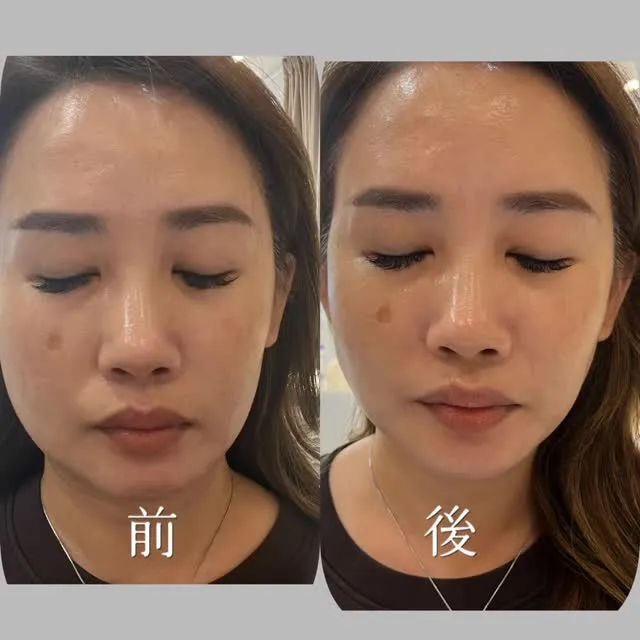 30+老化速度‘’飛快‘’ 膠原蛋白流逝的讓你猝不及防 怎麼辦？