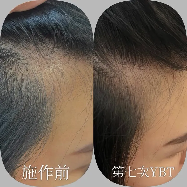 《高效精華啟動．強韌新生力》