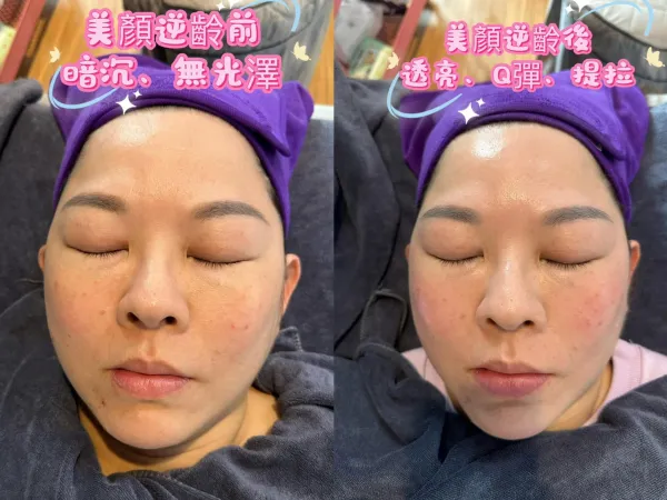 臉部SPA