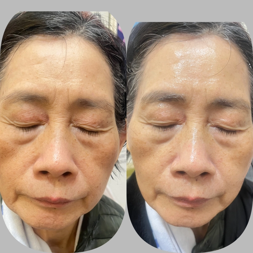 臉部SPA｜台中臉部保養