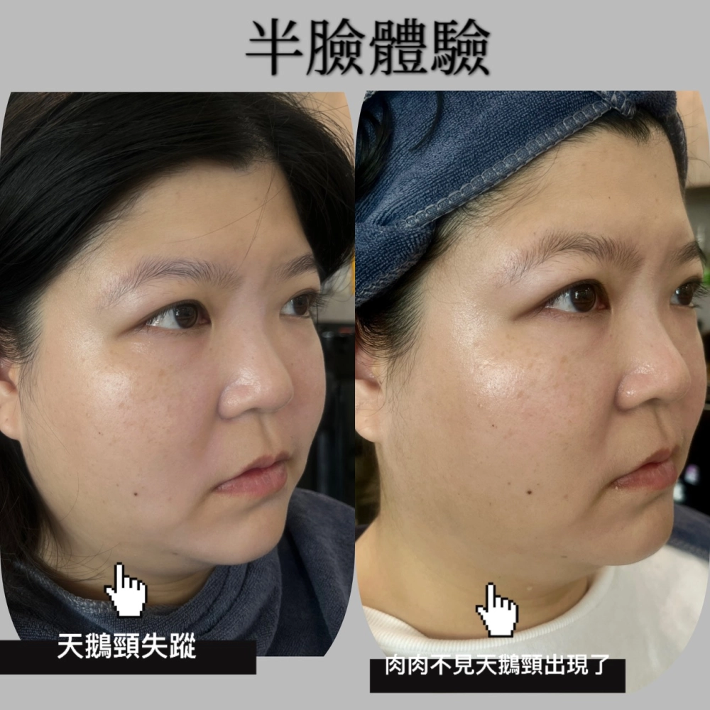 臉部SPA｜台中臉部保養