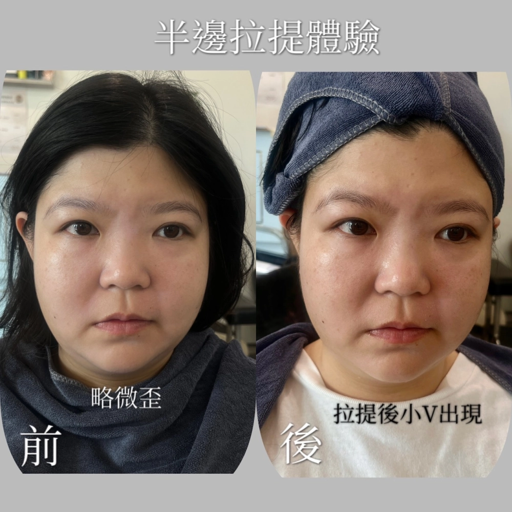 臉部SPA｜台中臉部保養