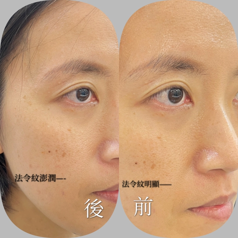 臉部SPA｜台中臉部保養