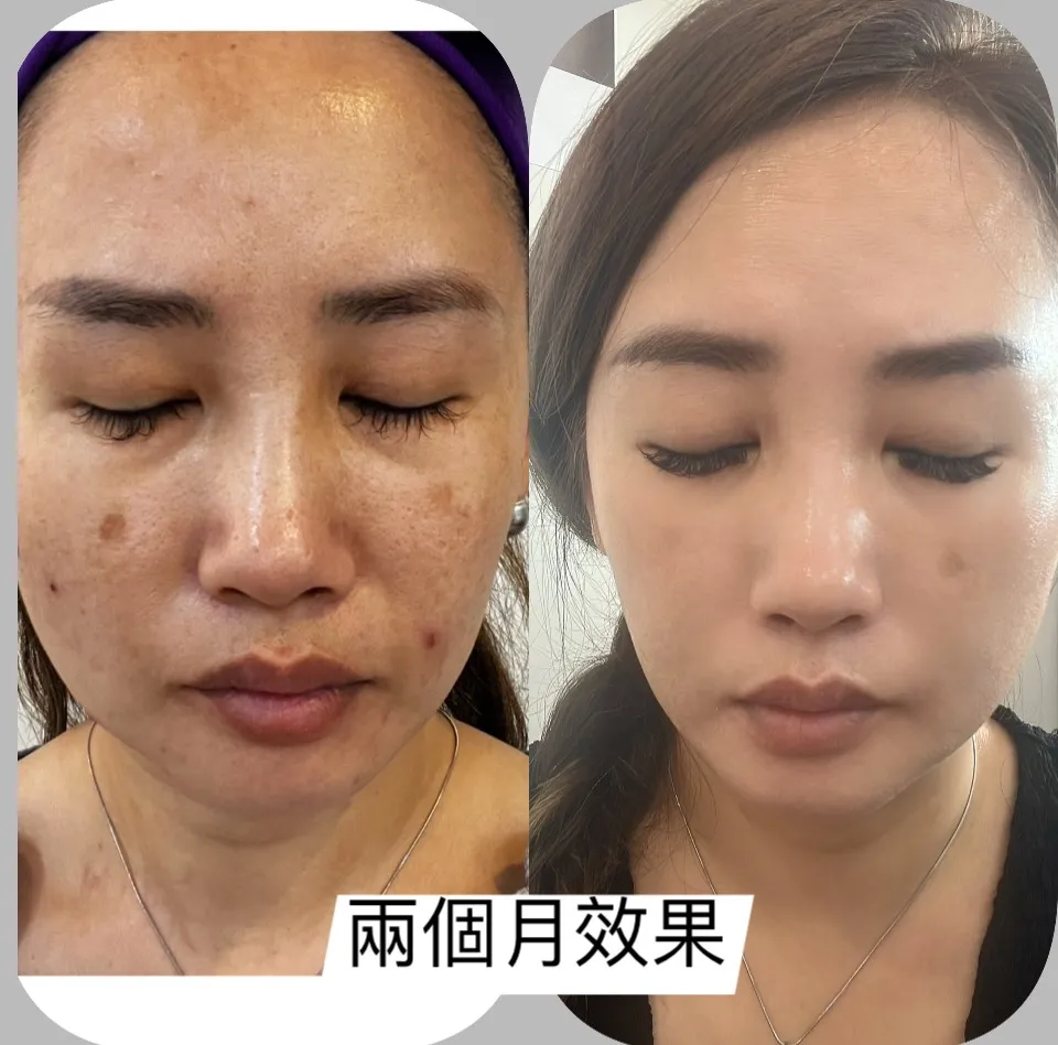 臉部SPA｜台中臉部保養