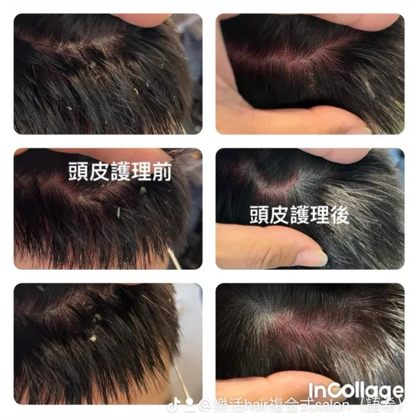頭皮護理｜台中頭皮護理｜台中頭皮SPA