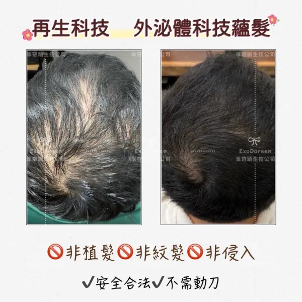 蘊髮作品｜台中蘊髮｜台中落髮問題