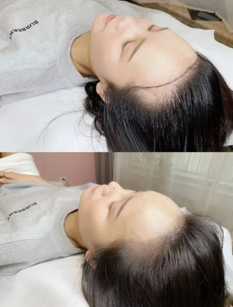 【髮際線課程創業班】