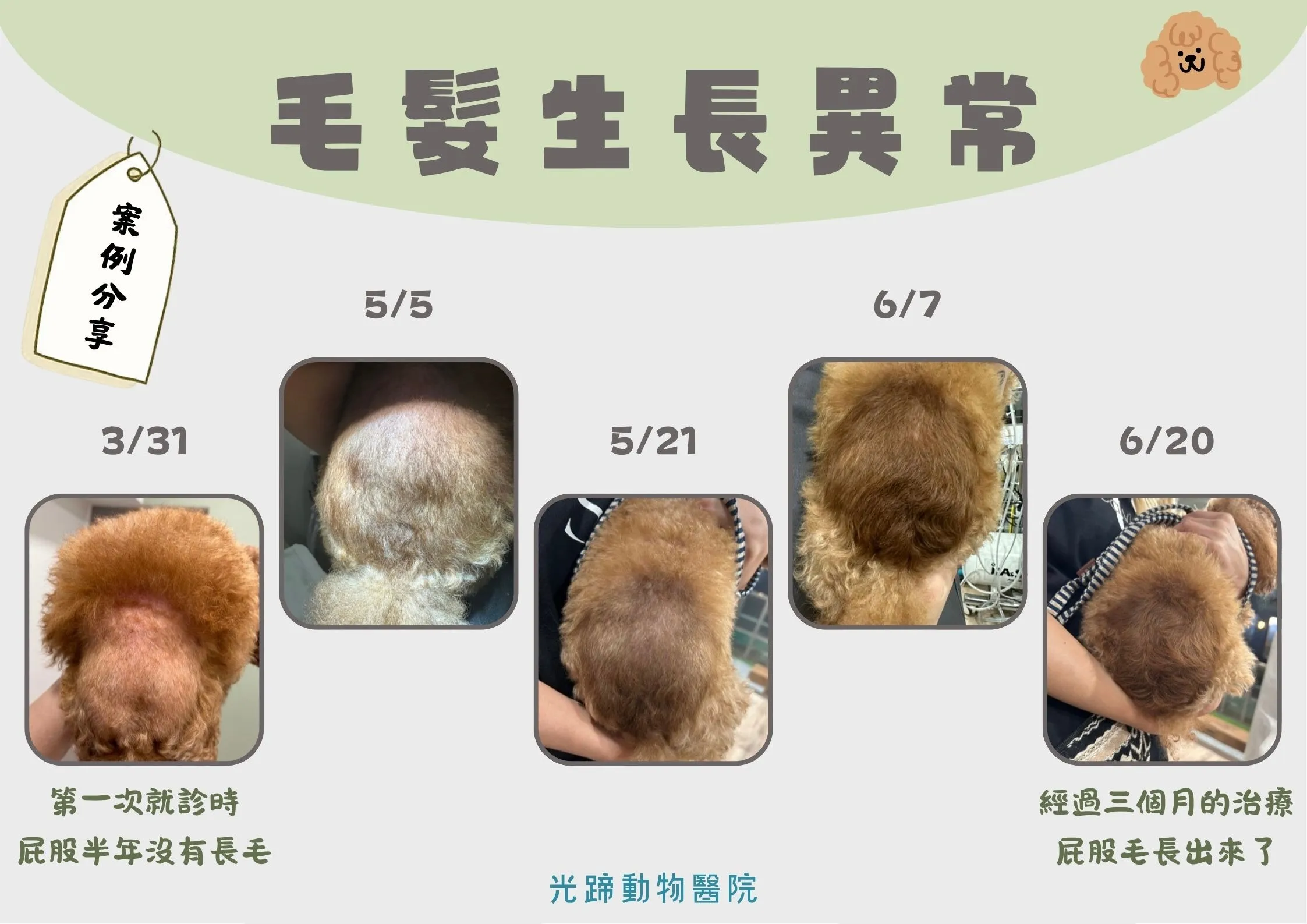毛髮生長異常