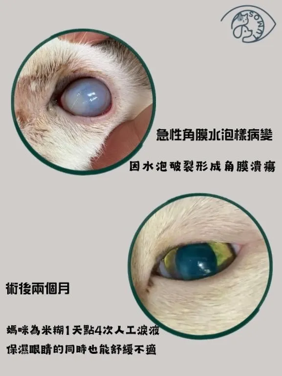 【眼睛突然變白、變霧？小心不是單純老化！】