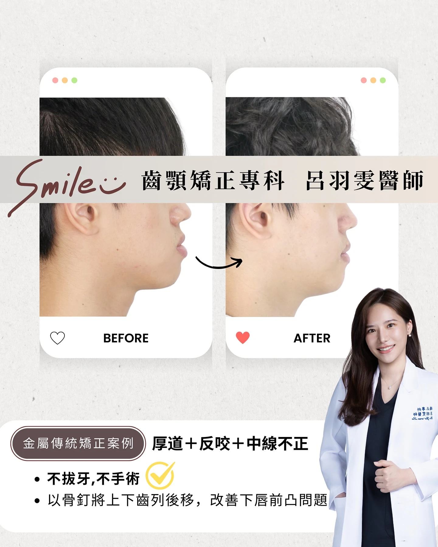 《 案例分享｜厚道+反咬+中線偏移》