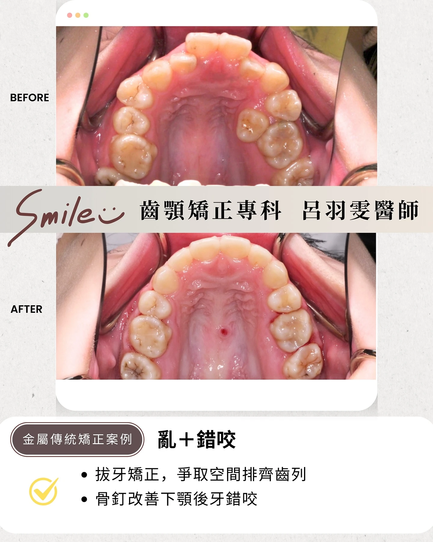 《案例分享｜⚡️極度擁擠》