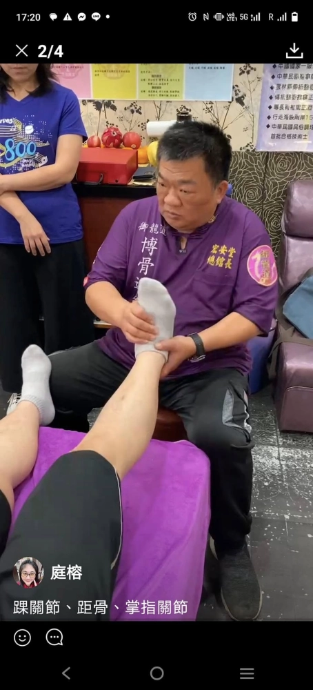 腱鞘囊腫