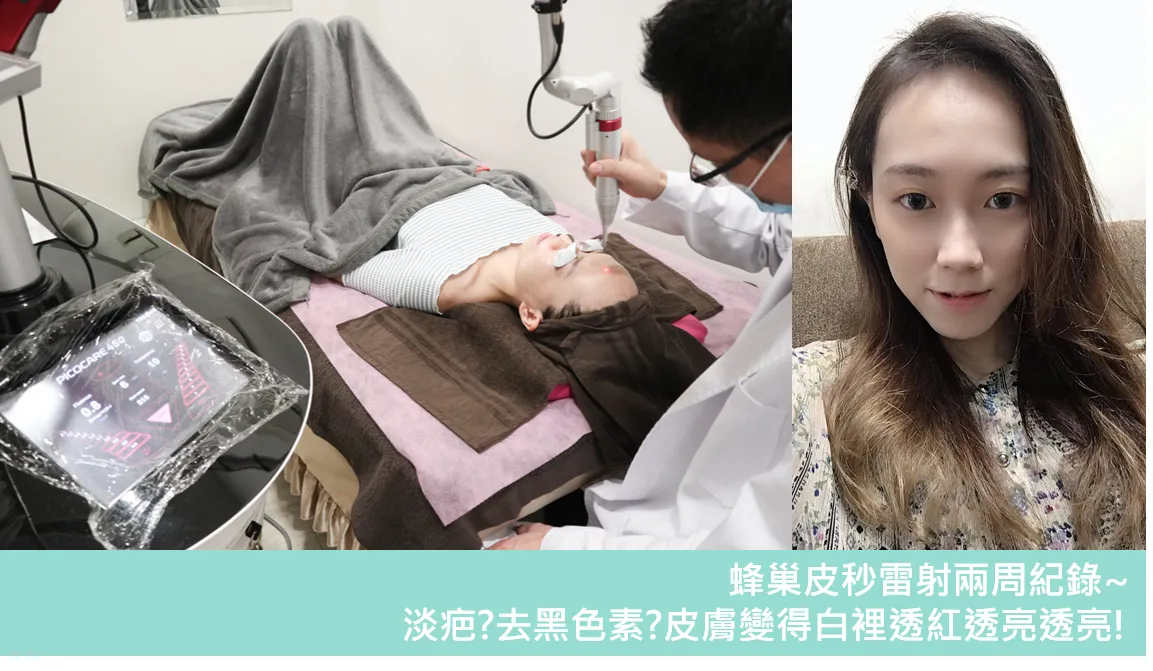 台中媄婧美學診所第一次皮秒心得記錄 皮秒術前注意事項、術後保養&皮秒雷射效果