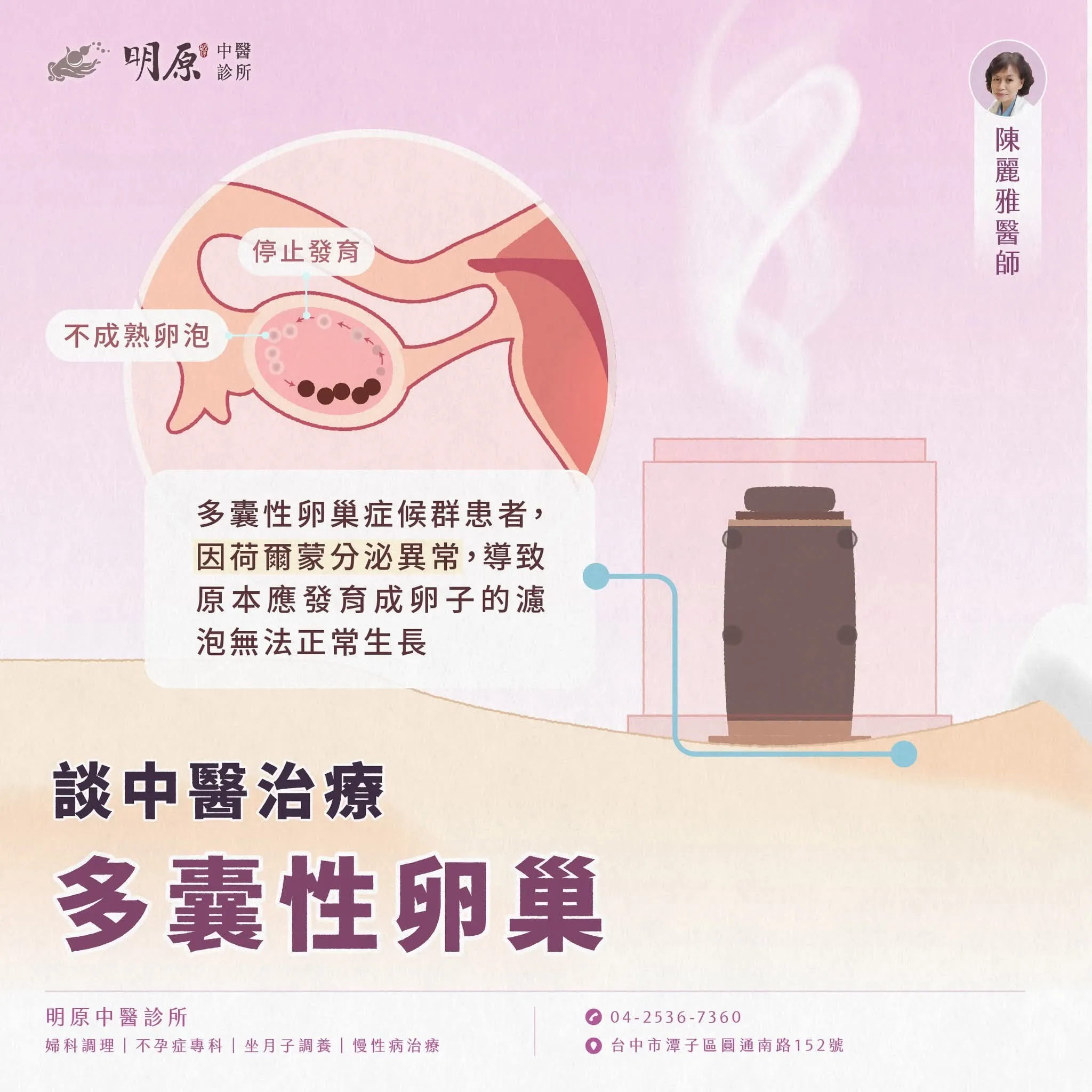 40歲的鄭小姐月經來之前會滴滴答答十餘天，月經來的日期也稍有延遲，西醫檢查：多囊卵巢。吃中藥一個月後月經準時報到，也沒有經前淋漓的現象。