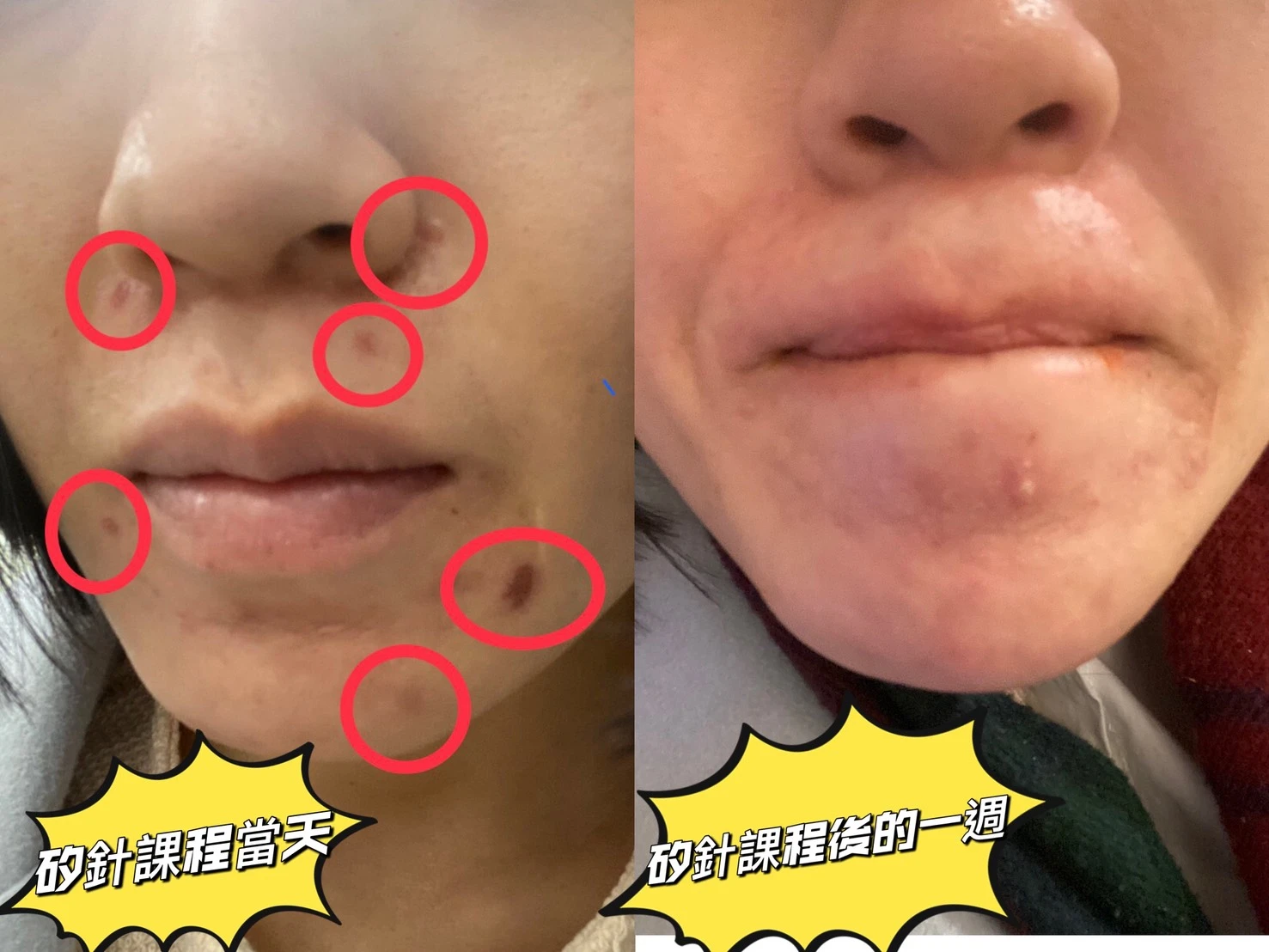 做臉｜臉部保養