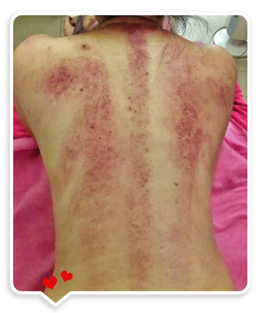 背部放鬆・循環保養系列